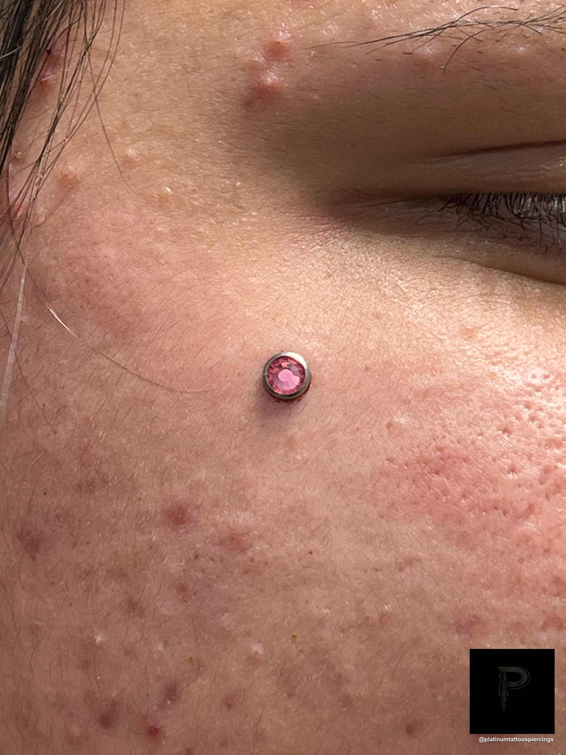 Dermal Piercing | Implant Grade Titanium | Platinum Body Piercings, North Star Mall, San Antonio TX